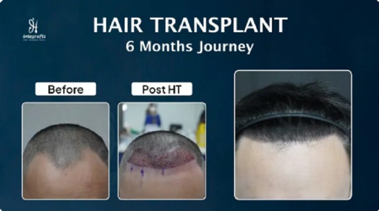 Transformasi Bukan Soal Penampilan Tapi Tentang Bagaimana Mendapat Semangat Baru dan Kepercayaan Diri dalam Hidup
